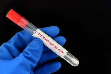 Naklejka premium Nasopharyngeal swab from patient for COVID-19 test by using RT-PCR method 