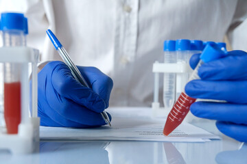 doctor or laborant describes the analysis result from the test tubes in a lab