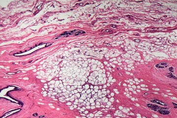Human mammary gland cells under the microscope