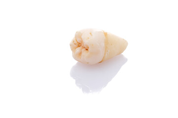 Fototapeta na wymiar Wisdom tooth close-up white isolated
