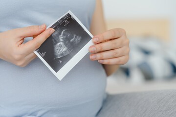 pregnant woman holding ultrasound scan on her belly