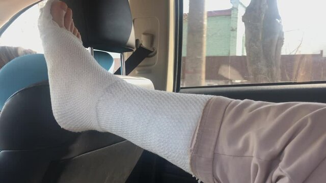 A close-up of a woman's leg in a plaster boot in the back seat of a car.