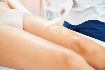 Dermatologist removing the excess gel from the female leg