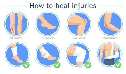 Healing of different injuries poster. Cartoon vector illustration. Methods of bandaging foot, knee, hand wounds with elastic roller. Treating, healing, bleeding, first aid concept for banner design