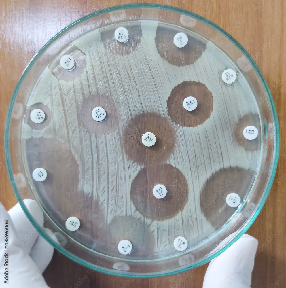 Poster Antimicrobial susceptibility testing in culture plate. Drug sensitivity test, antibiotic sensitivity.