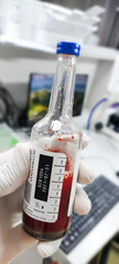 Culture bottles containing liquid media and human blood.Hemoculture incubator. Blood culture bottle.