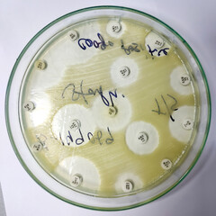 Antimicrobial susceptibility testing in culture plate. Drug sensitivity test, disk drug, antibiotic sensitivity.
