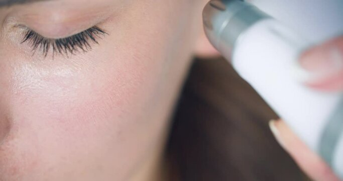 The close-up cheek of a female client who is having a non-injection mesotherapy procedure by using Dermadrop TDA device. 