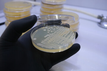 growth of bacterial colonies on agar media in a plastic plate