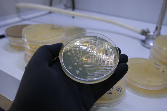 growth of bacterial colonies on agar media in a plastic plate