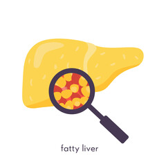 Unhealthy fatty liver. Damaged human organ under magnifying glass. Medical research study of fat liver tissue. Vector illustration in flat cartoon style isolated on white. - obrazy, fototapety, plakaty