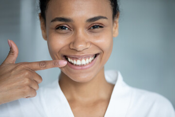 Happy African American girl pointing finger at toothy smile, showing healthy white teeth. Client satisfied with dentist service, enamel cleaning, whitening, dental care, orthodontic correction.