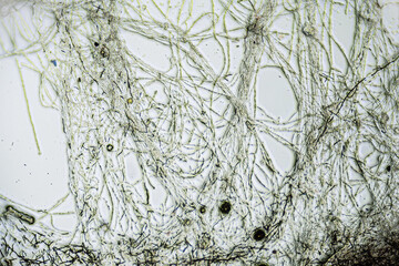 Kombucha tea macro close up under the light microscope, magnification of 100 times, microscope objective 10. Edge of tea jellyfish with threads