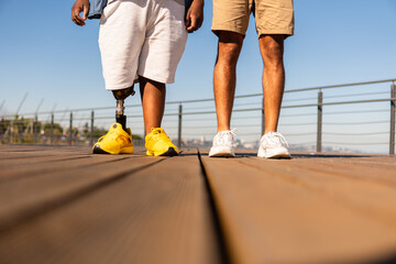 detail of man with prosthetic leg walking with friend.