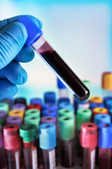 Technician working with blood tube sample for testing in the preanalytical lab. rack with tubes...