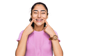 Hispanic teenager girl with dental braces wearing casual clothes smiling with open mouth, fingers pointing and forcing cheerful smile - obrazy, fototapety, plakaty