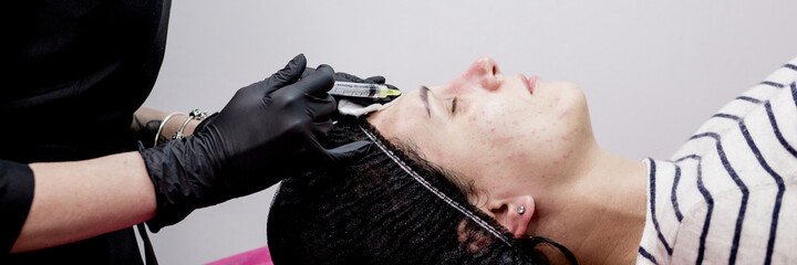 Cosmetologist doctor is making multiple injections biorevitalization with hyaluronic acid in woman...