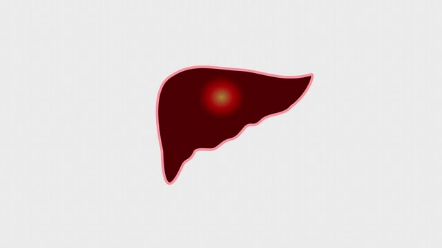 Human Internal Digestive Organ Liver Anatomy Animation Concept. 2D.Liver with pain. Throbbing pain in the liver. Flat style