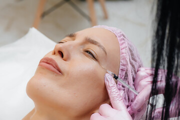 Cosmetology procedure for lip augmentation and wrinkle removal for a young beautiful girl....