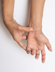 Fototapeta premium Trigger Finger a defect in a tendon causing a finger to jerk or snap straight when the hand is extended.