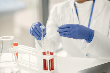 Laboratory worker studying blood samples to detect pathologies