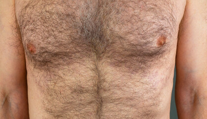 A man with a hairy male breast close-up. Long chest hair - Powered by Adobe