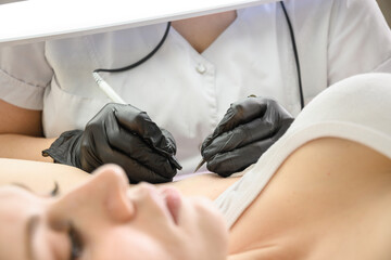 Procedure removal of hair permanently in a woman's armpits using metod electro epilation. Doctor working in cosmetology beauty salon. Close up.