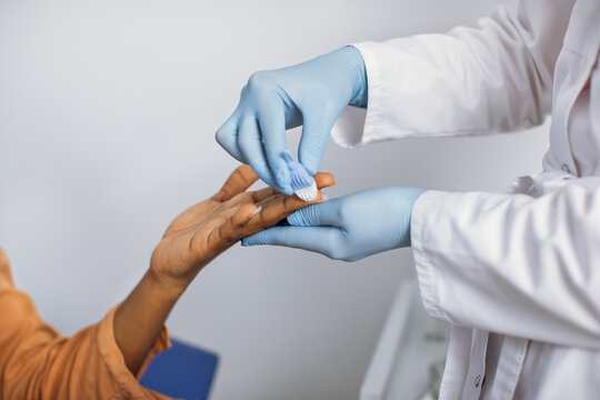 Close up cropped photo of hands of a female lab worker in white coat and gloves, taking a patient's blood sample, using painless scarifier. Black woman patient ready to blood test