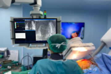 Close up television monitor show picture of Doctors team perform heart surgery and blurry  the operating room in the hospital background