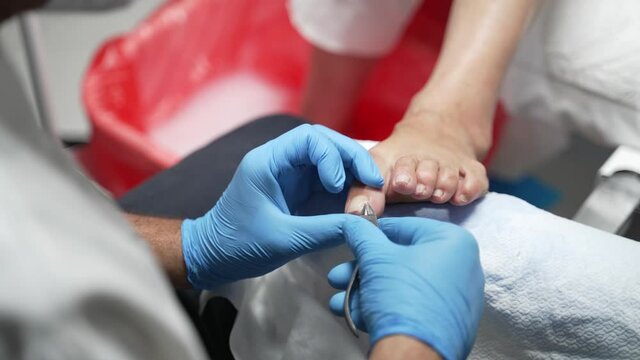 A professional medical pedicure doctor helps to prevent ingrown nail in a young man's feet using professional tools and helps the client to have clean and healthy fingers with no fungal

