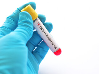 Naklejka premium Brazilian variant of COVID-19, blood sample tube positive with Brazilian strain of COVID-19 virus