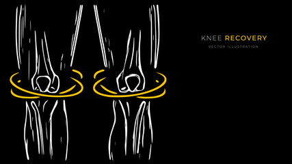 Vector illustration of knee recovery. Creative medical poster or banner.
