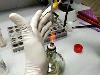 Microbiologist hold a platinum loop for Sterilization with red heat by spirit lamp to perform urine...