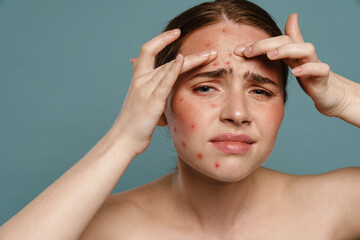 Ginger shirtless woman frowning and squeezing pimple on her face