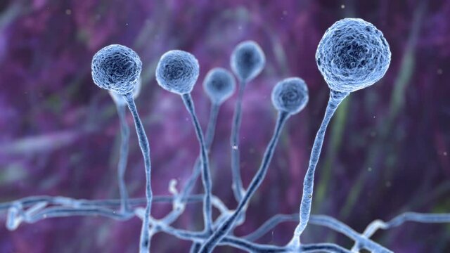 Mucor mold, black fungus, yellow fungus, 3D animation. Opportunistic fungi that cause mucormycosis involving skin, nasal sinuses, brain and lungs. Complication of Covid-19