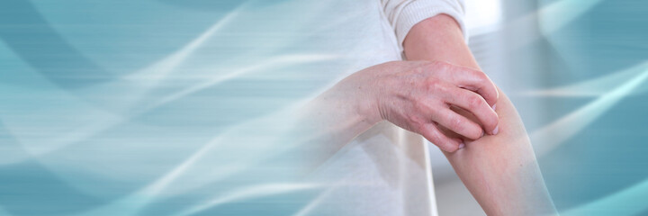 Woman having itchy and scratching her arm; panoramic banner