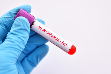 Obraz premium H10N3 bird flu test, blood sample tube for influenza A virus subtype H10N3 test