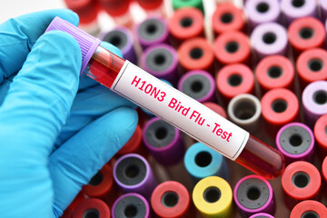 Fototapeta premium H10N3 bird flu test, blood sample tube for influenza A virus subtype H10N3 test