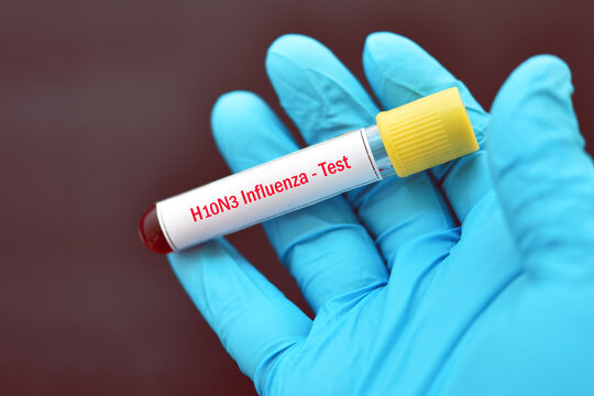 H10N3 bird flu test, blood sample tube for influenza A virus subtype H10N3 test