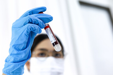 Scientist holding Coronavirus covid-19 infected blood sample tube DNA testing of the blood in the...
