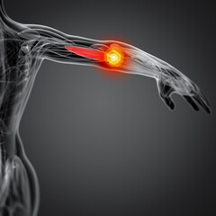 medical  illustration of the Brachialis