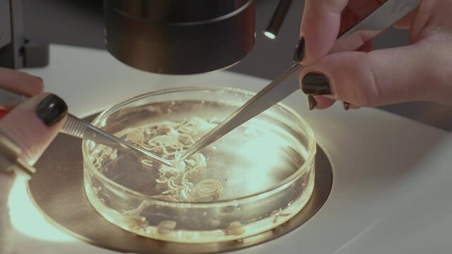 Close-up of a parasite in a Petrie dish as a lab technician examines the sample under the microscope.