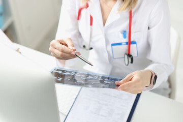 Doctor examines X-ray of patient at work table