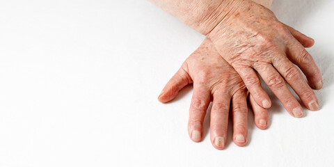 Fototapeta premium Aging hands of an old 80 year old woman with age spots, deep wrinkles on the skin and flaky nails. Skin aging and elderly care concept. Female hands on white fabric