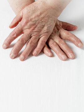 919 Best Age Spots On Hands Images Stock Photos Vectors Adobe Stock 919 Best Age Spots On Hands Images Stock Photos Vectors Adobe Stock