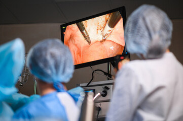 Monitor depicting endoscopic surgery. Endoscopic camera - 437255227