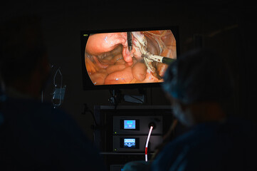 Monitor depicting endoscopic surgery. Endoscopic camera - 437255279