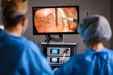 Monitor depicting endoscopic surgery. Endoscopic camera - 437255283