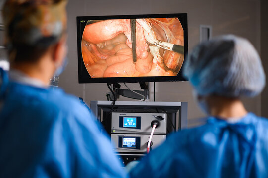 Monitor depicting endoscopic surgery. Endoscopic camera