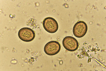 Egg of Taenia or tapeworm in human stool, analyze by microscope, original magnification 400x